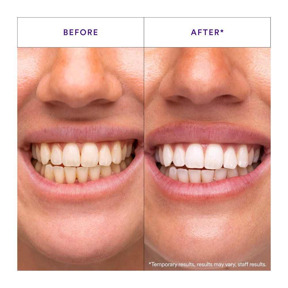 Hismile V34